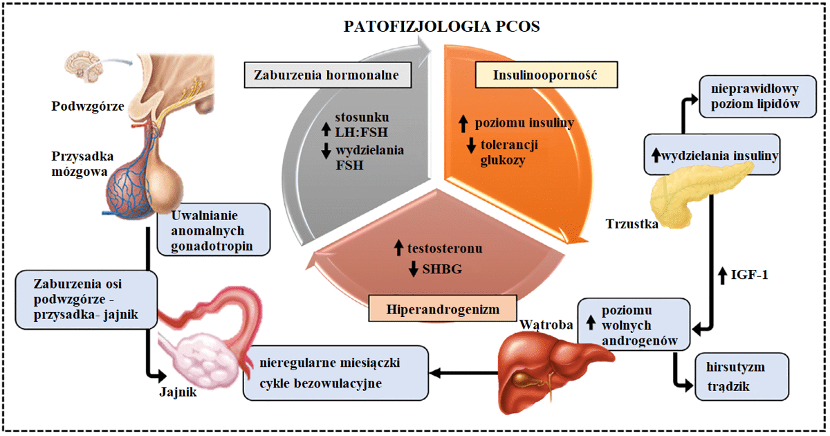 Źródło: Bulsara J. i inni, A review: Brief insight into Polycystic Ovarian syndrome, Endocrine and Metabolic Science, Vol. 3, 2021, 100085
