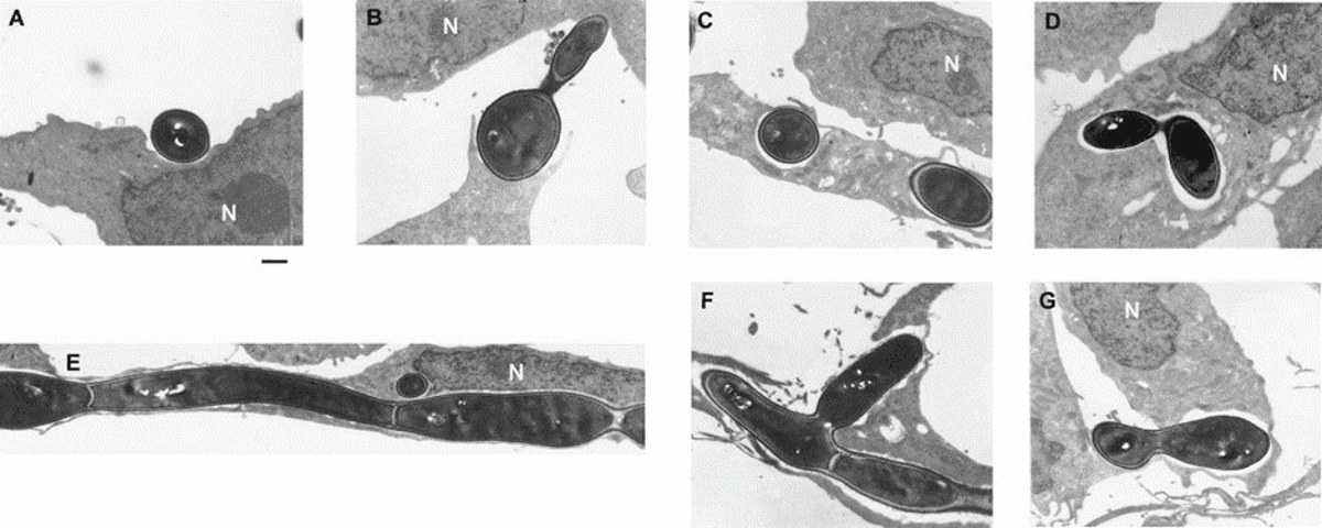 A, B –łączenie się C. albicans z komórkami BMEC (brainmicrocascularendothelialcells, tłum. komórki śródbłonka mikronaczyniowego mózgu), C, D –C. albicans w wakuoli BMEC oraz replikacja grzyba, E, F – podział i rozprzestrzenianie się C. albicans oraz rozpad komórki BMEC, G- podział C. albicans wewnątrz oraz poza komórką śródbłonka mikronaczyniowego mózgu. Źródło: https://www.ncbi.nlm.nih.gov/pmc/articles/PMC98530/