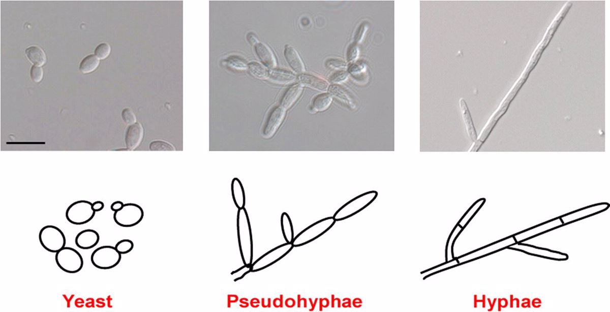 Morfologia komórek Candida albicans na poszczególnych etapach rozwoju. Źródło: https://journals.asm.org/doi/10.1128/ec.05085-11